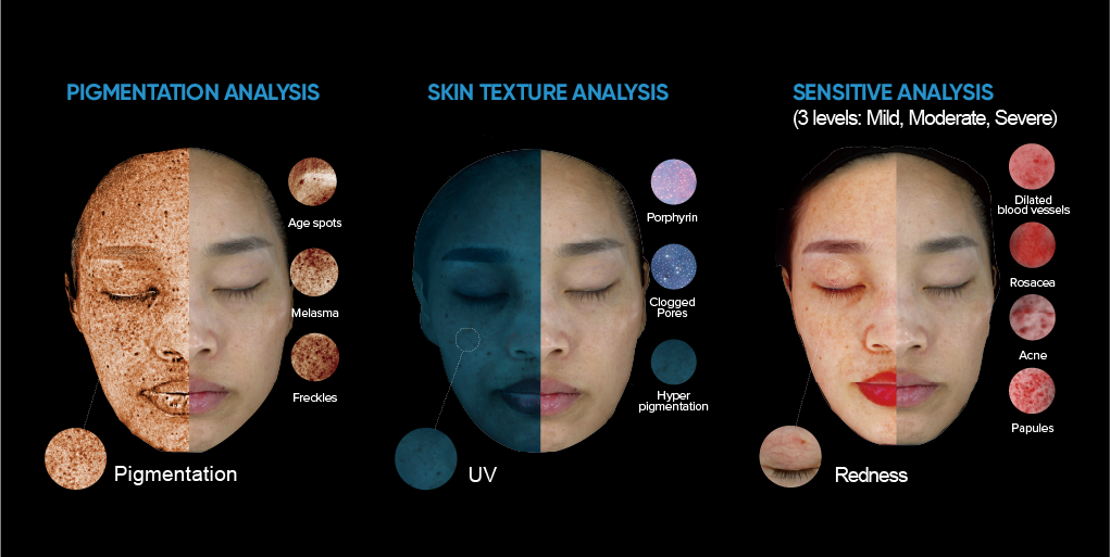 ISEMECO 3D D9 Skin Analyzer 3D Full-facial Modeling Suitable for doctors, Cosmetic Surgeons, Dermatologists details