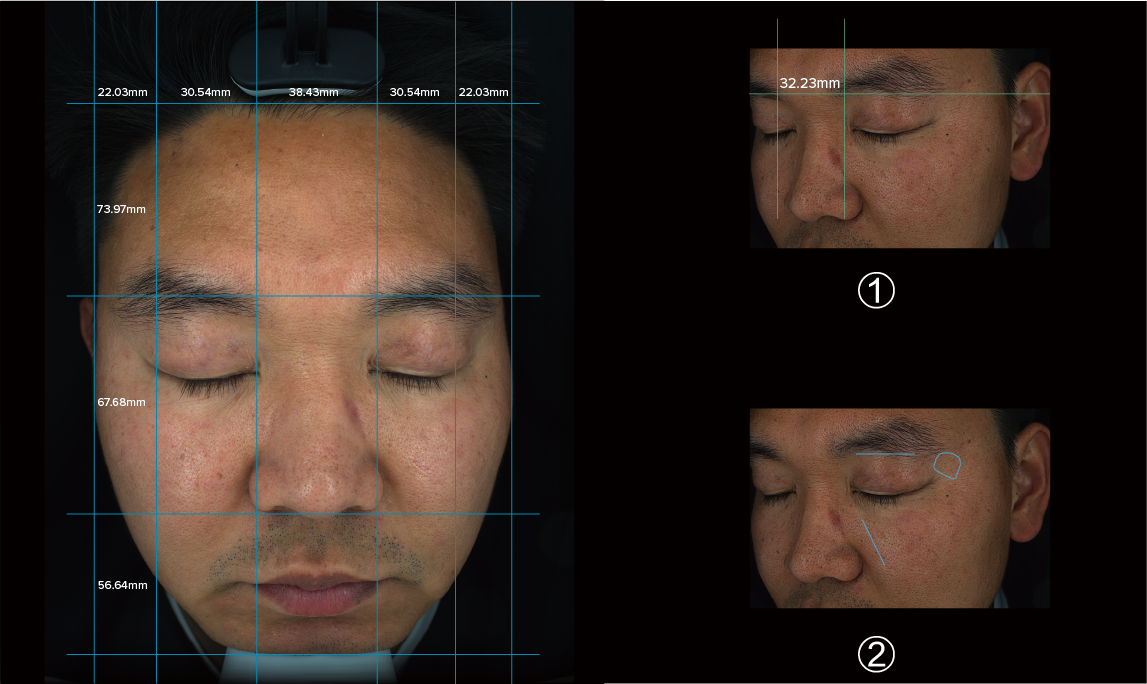 ISEMECO S7 Skin Analyzer,Effectively Assist Dermatologists manufacture