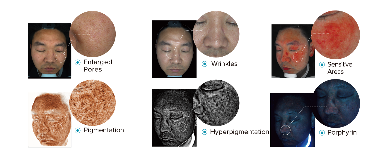 ISEMECO S7 Skin Analyzer,Effectively Assist Dermatologists supplier