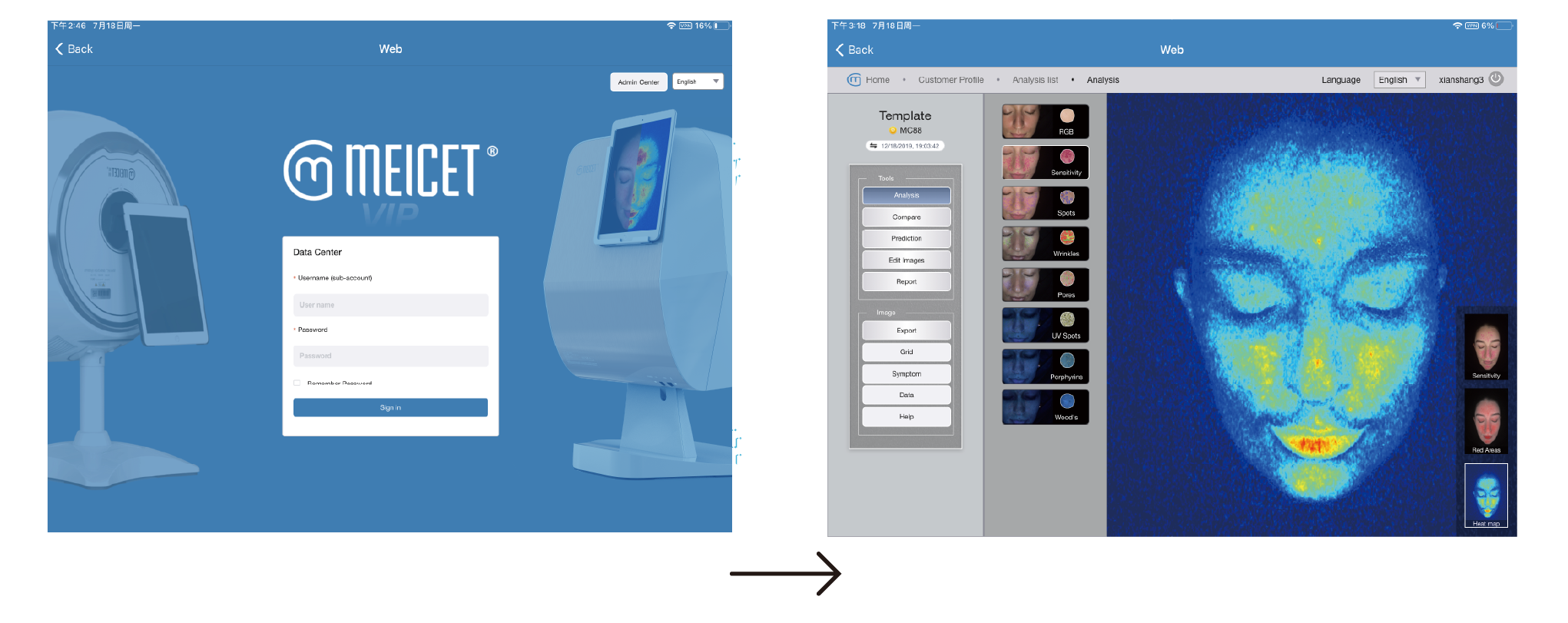 Meicet 3D Full Facial Skin Analyzer Commercial Use MC88 supplier