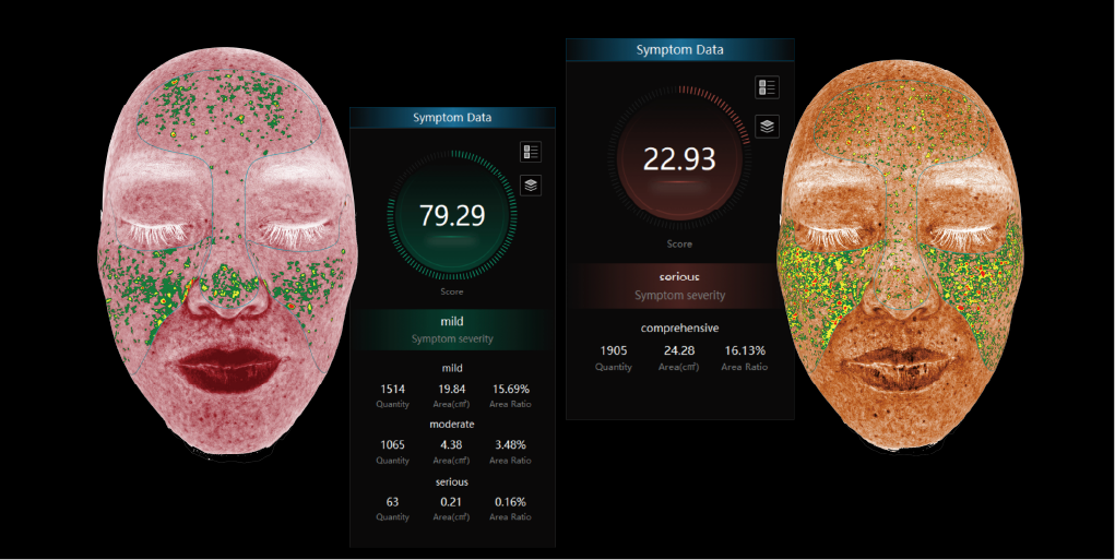 ISEMECO 3D D9 Skin Analyzer 3D Full-facial Modeling Suitable for doctors, Cosmetic Surgeons, Dermatologists details