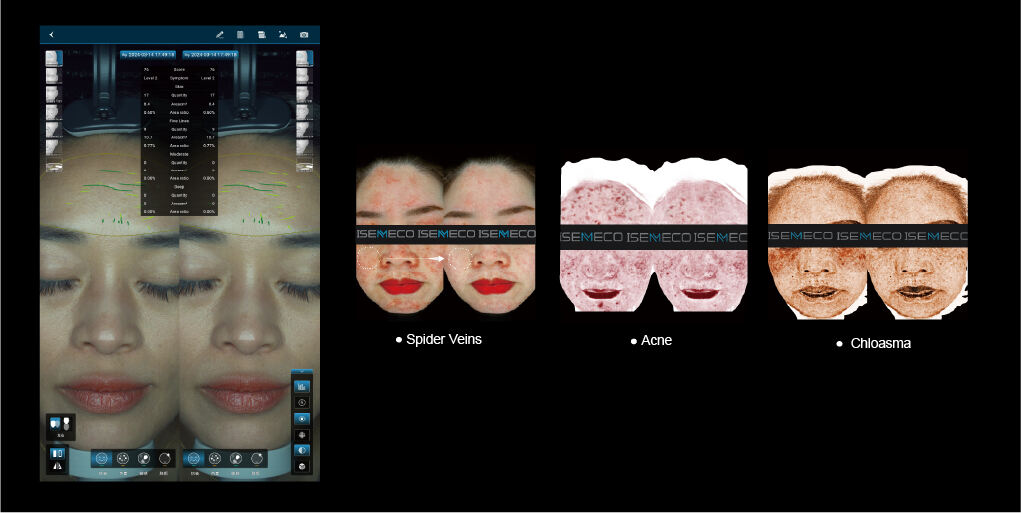 An "all-in-one" Skin Imaging Analyzer Pro A supplier