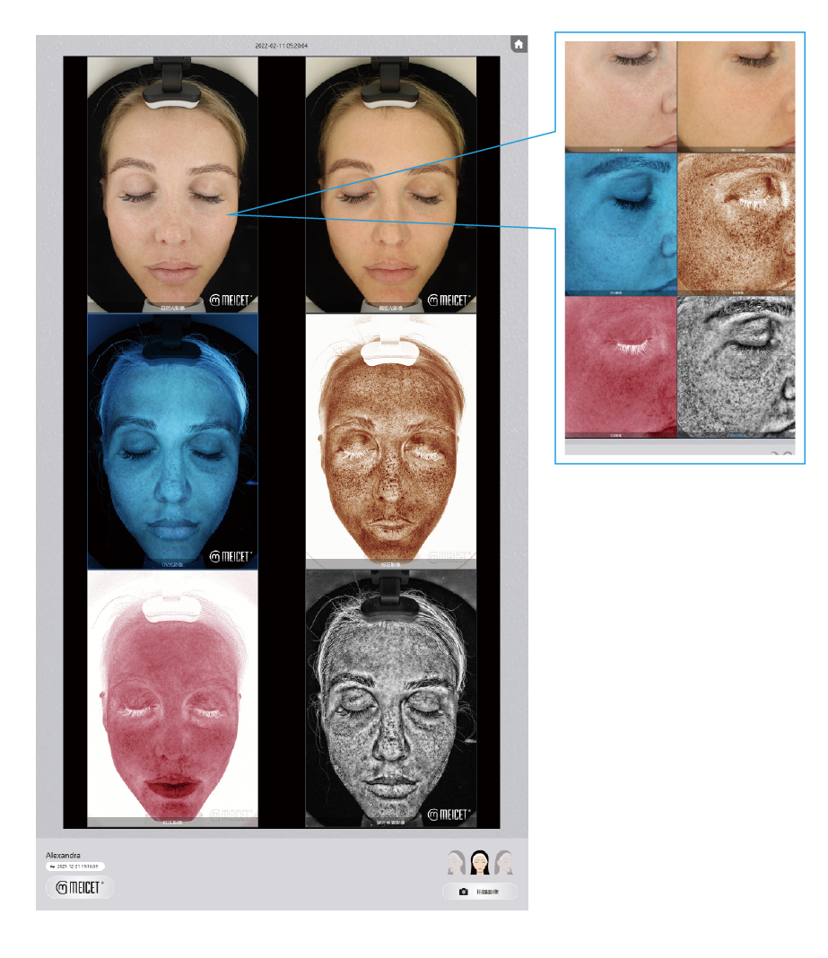 Resur Skin Image Analyzer , High-end facial skin imaging analysis details