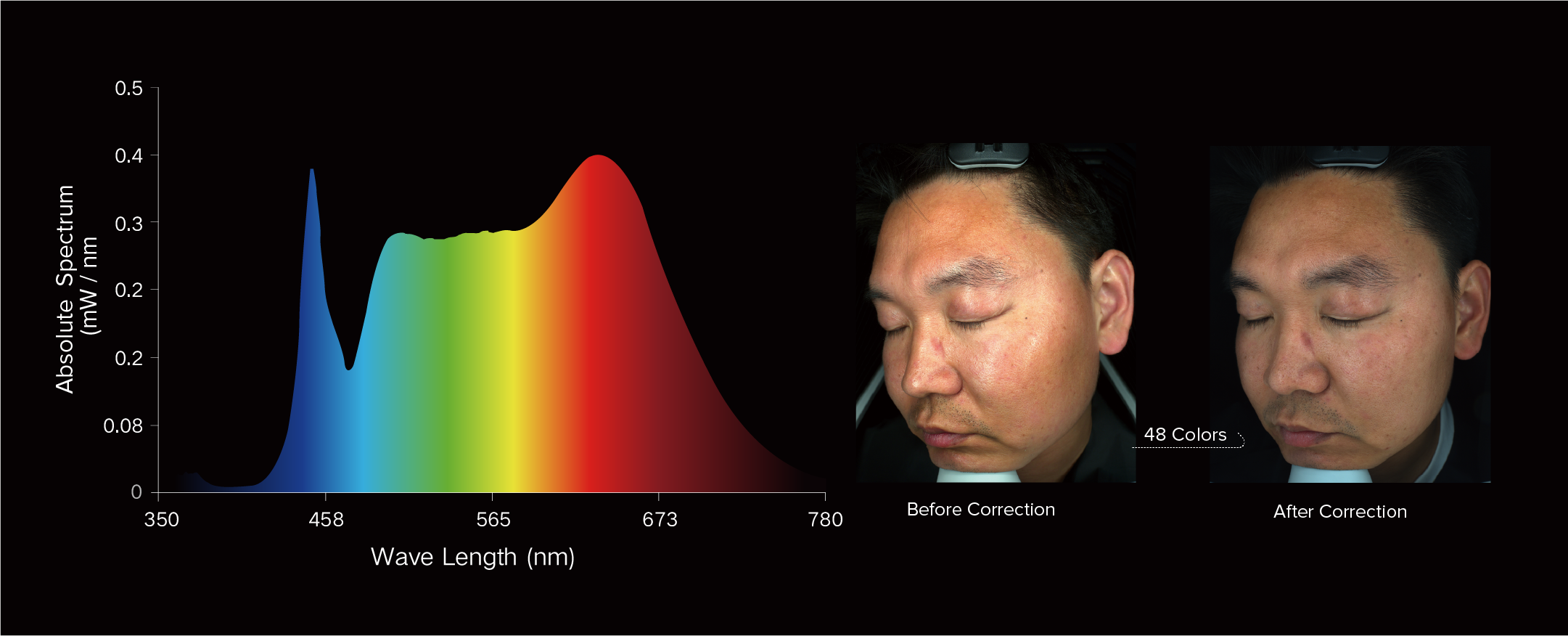 ISEMECO S7 Skin Analyzer,Effectively Assist Dermatologists details