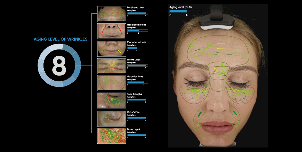 ISEMECO 3D D9 Skin Analyzer 3D Full-facial Modeling Suitable for doctors, Cosmetic Surgeons, Dermatologists details