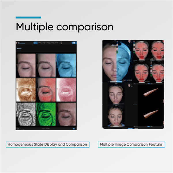 How to Use Skin Pigment Analysis?