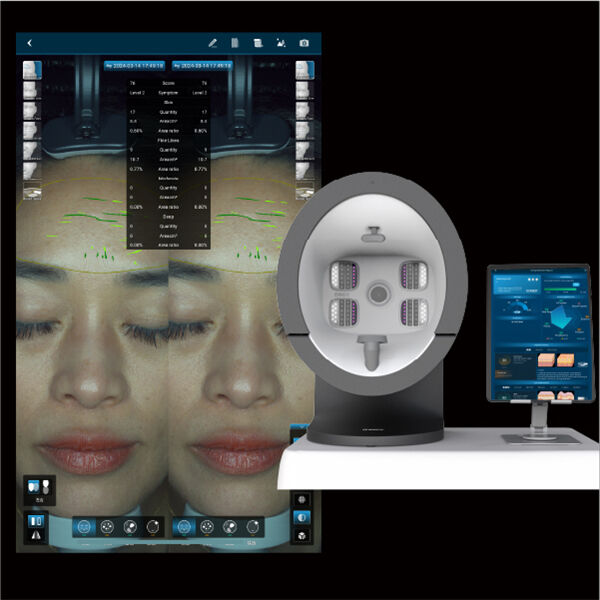 Use of Skin Scanner Analysis