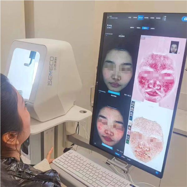 How to Use the Professional Skin Analysis Machine