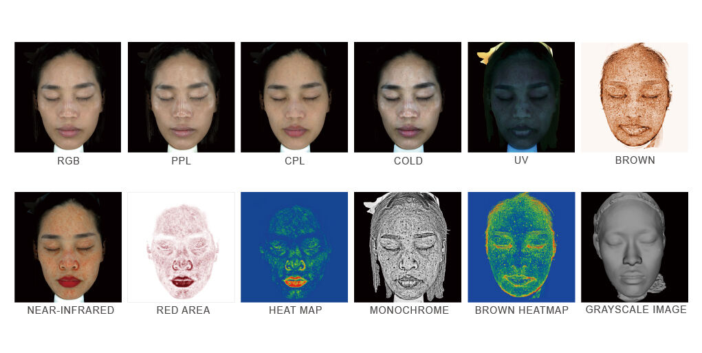 Resur Skin Image Analyzer , High-end facial skin imaging analysis supplier