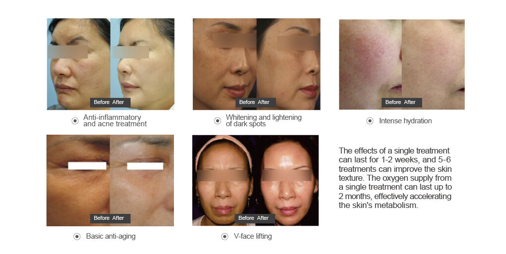 Before and After Comparison of the Treatment