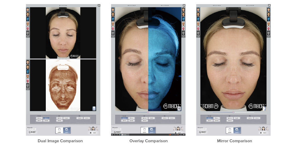 Resur Skin Image Analyzer , High-end facial skin imaging analysis details