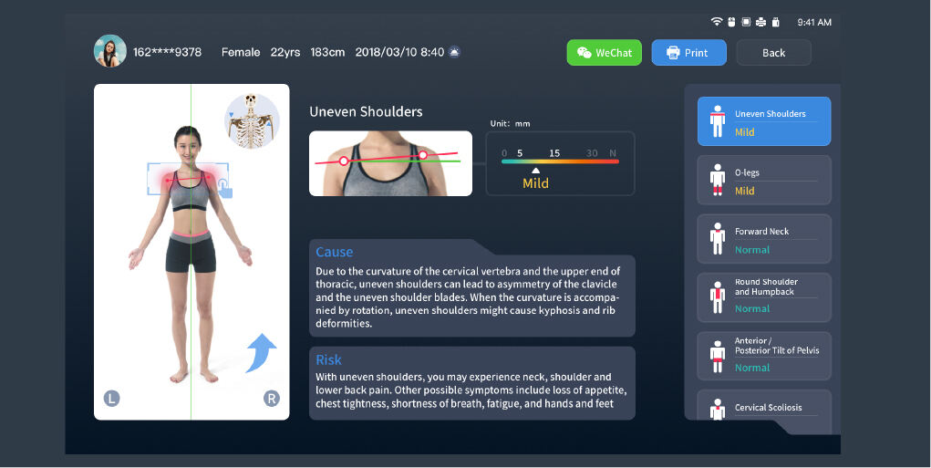 Display of Postural Assessment