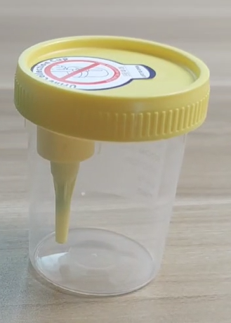 Innovation of Urine Test Pots