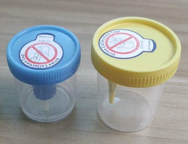 Innovation in Split Cup Urine Test: