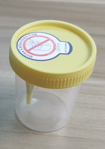 Innovation in Sterile Sample Cup Technology