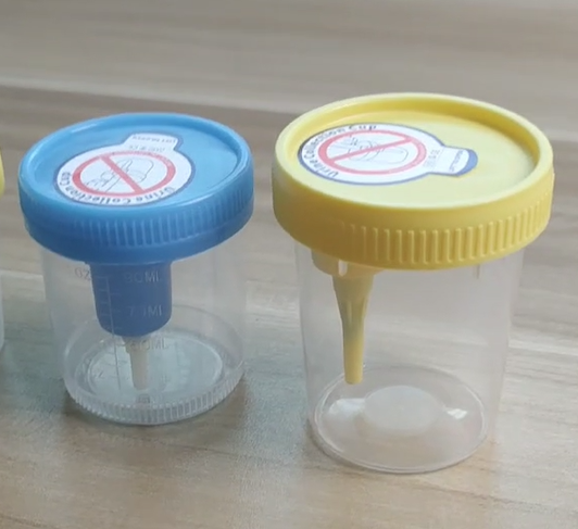 Innovation in Urine Containers