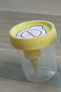 Innovation in Urine Sample Collection