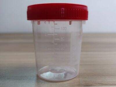 What container is used for urine test