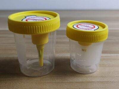 Can I use plastic cup for urine sample