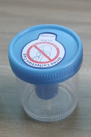 Innovation and Safety Precautions in Pee Sample Containers