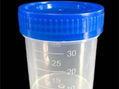 Apa yang Harus Diperhatikan dalam Gelas Pengumpul Urin Berkualitas Tinggi