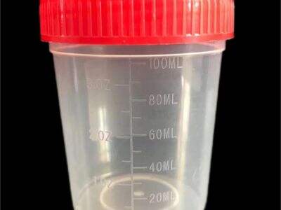 Sterile vs Non-Sterile Urine Cups: What Hospitals Need to Know