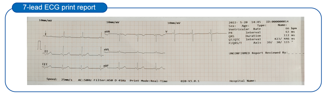 3 Channel 12 Lead Portable ECG Machine for Animal Veterinary Medicine EKG Device details