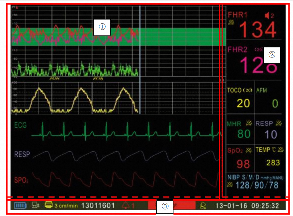 Portable CTG Fetal Monitor Machine with 12.1 factory