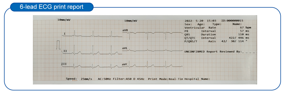 3 Channel 12 Lead Portable ECG Machine for Animal Veterinary Medicine EKG Device manufacture