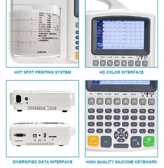 3 Channel 12 Lead Portable ECG Machine for Animal Veterinary Medicine EKG Device details