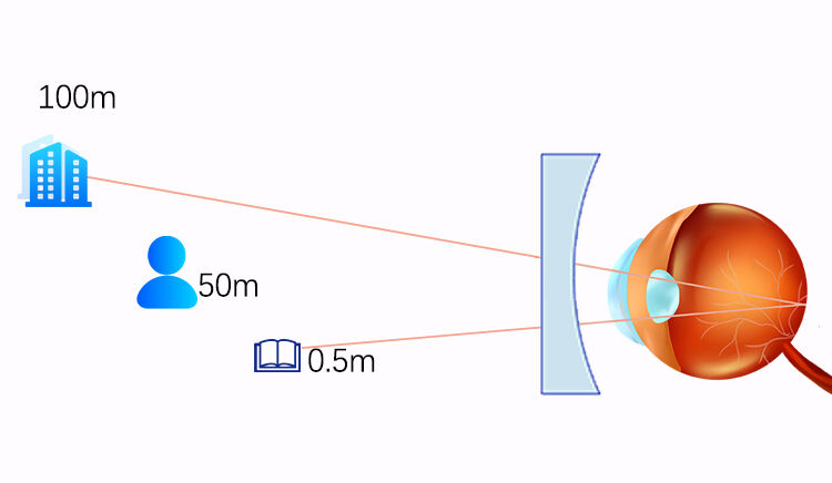 Photon 1.56 blue cut optical lens glasses multifocal progressive lens blue block lens freeform progressive lenses supplier