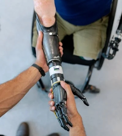 Taijie’s Prosthetics equipped with Technology to Unlock your Potential