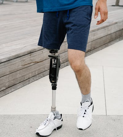 Taijie’s Prosthetics equipped with Technology to Unlock your Potential