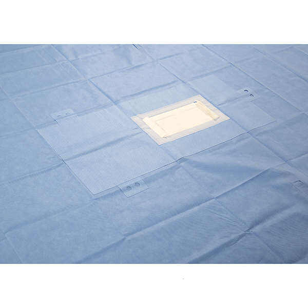 คุณภาพของการให้บริการผ้าคลุมศัลยกรรมแบบมีรูระบายอากาศ