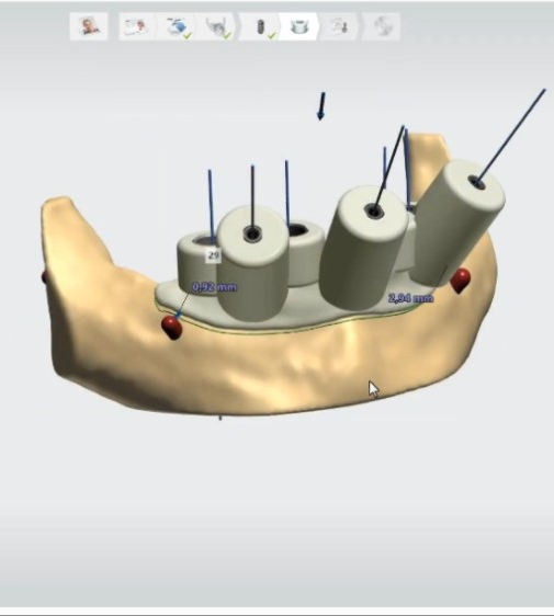 Advancing Dental Education and Collaboration with 3Shape's TRIOS