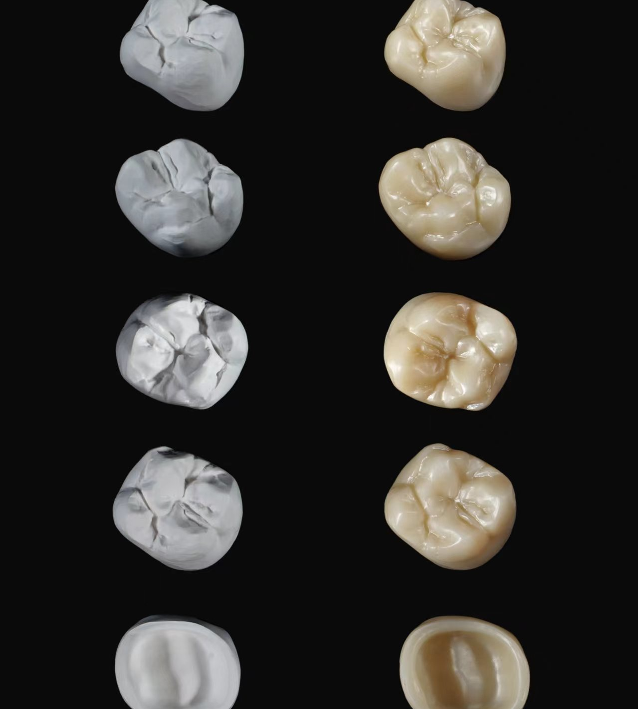 Precision Fit and Functionality with DPS Dental's Crown Technology