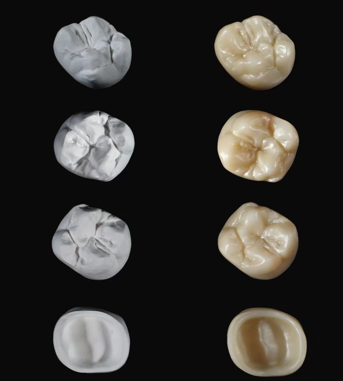 Precision Fit and Functionality with DPS Dental's Crown Technology