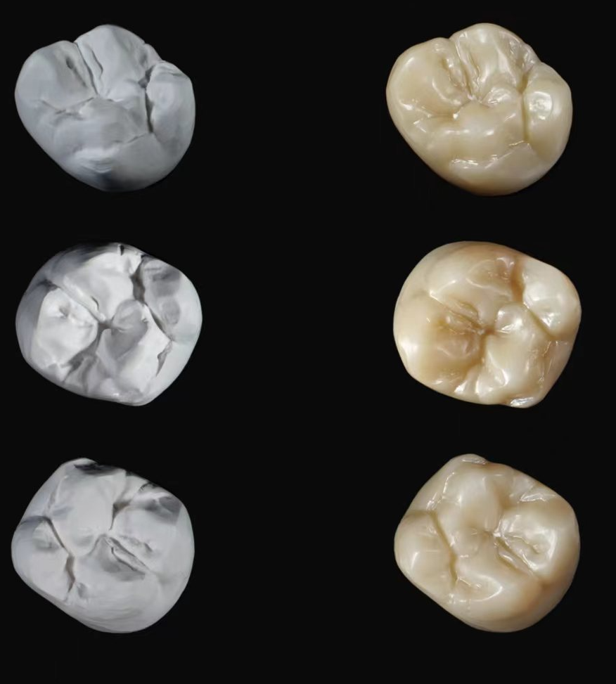 Innovative Design and Durability in DPS Dental's Crown Materials