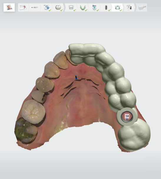 Empowering Dental Clinicians with 3Shape's Implant Studio