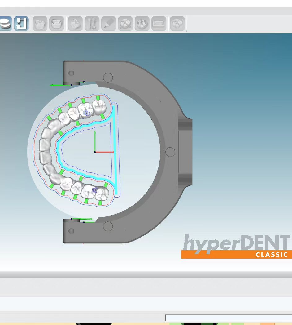 Seamless Integration of exocad with DPS Dental's CAD/CAM Systems