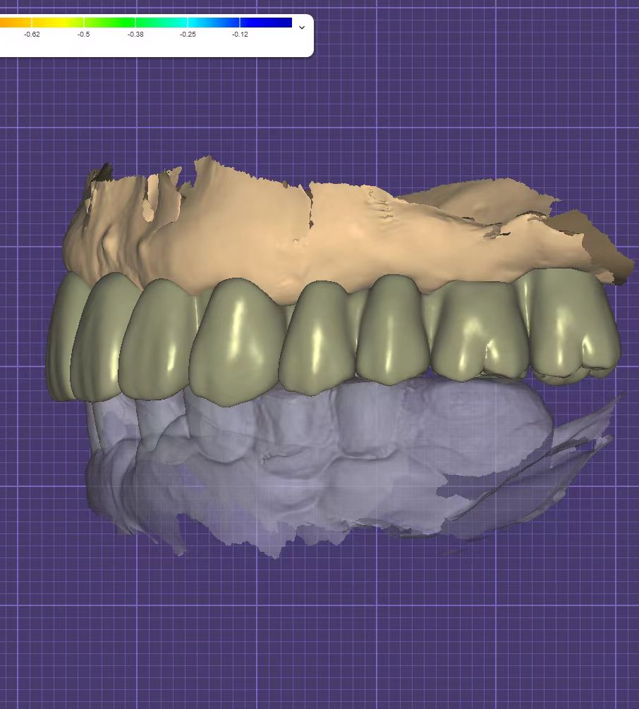 Seamless Integration of exocad with DPS Dental's CAD/CAM Systems