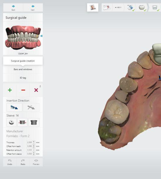 Empowering Dental Clinicians with 3Shape's Implant Studio