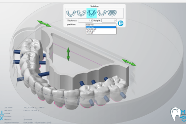 CAD/CAM Revolution in Dentistry