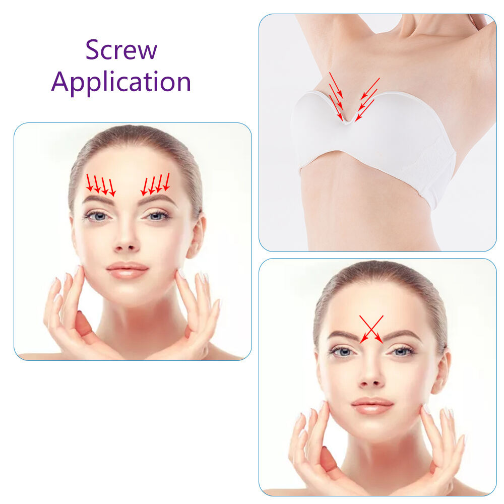 Korea Medical Cog Hios Pdo Tensores 26g 27g 60mm Facial Nose Lifting Filling Plla Double Screw Thread supplier