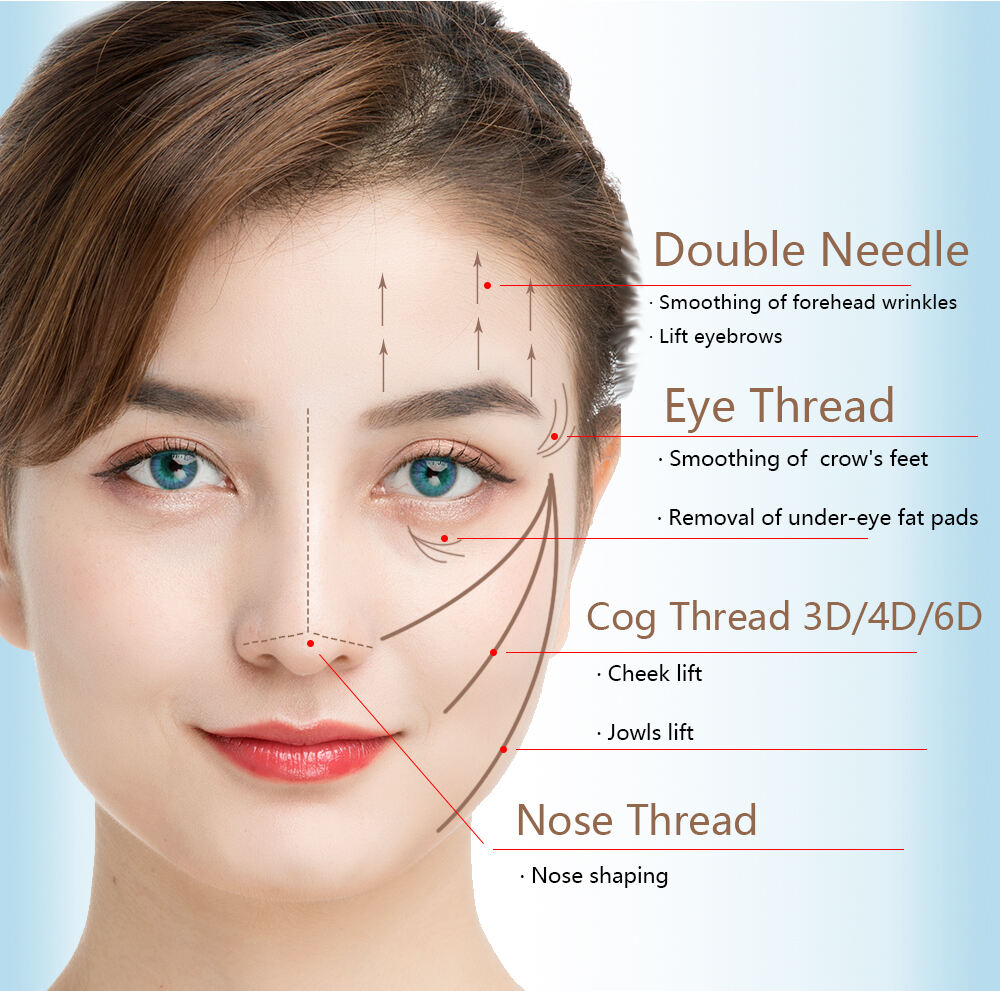 Fabbrica della Corea V Lifting Nose Mono 3D 4D 6D 8D Face Lifting Thread Pdo Plla Pcl Cog Threads
