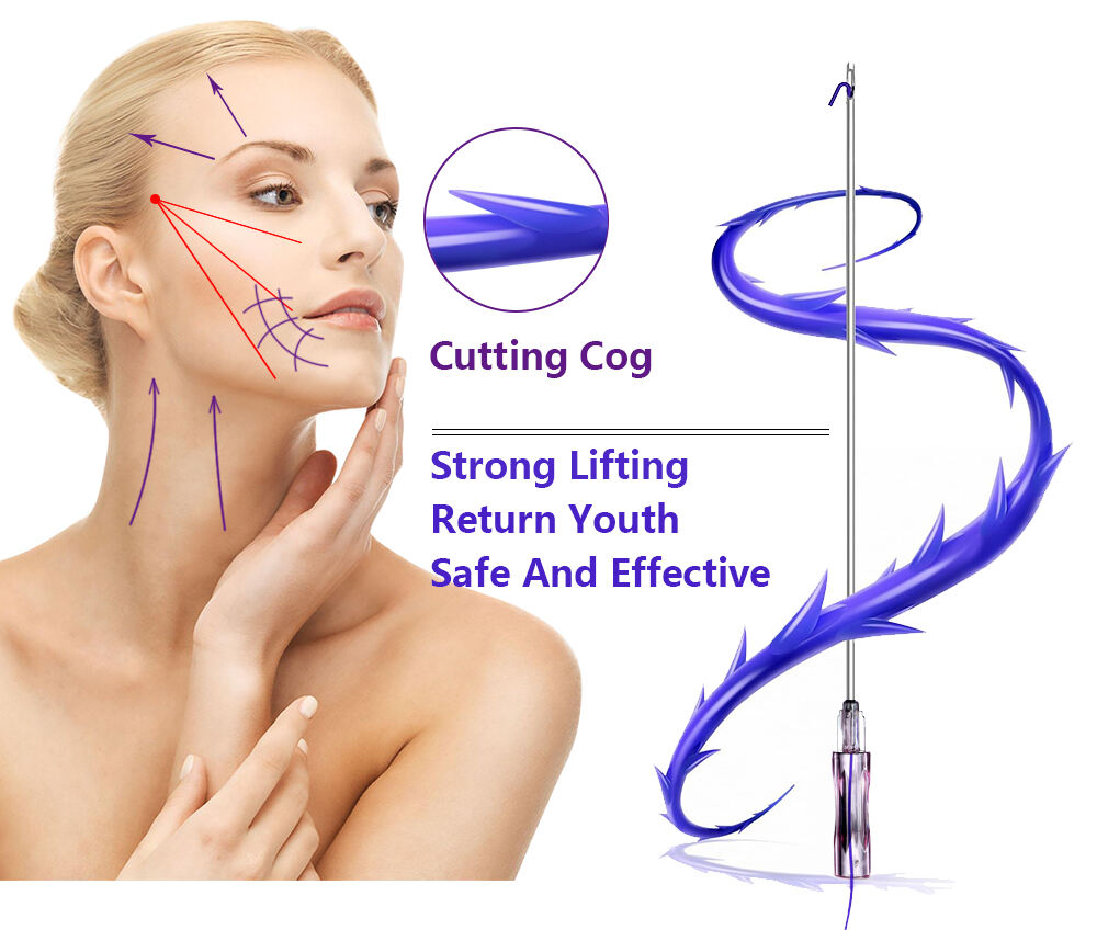 Korean Molding Barbed Cog Facial Tensioning Hilos Pcl Pdo Multi Smooth Wrinkles Wpdo Mono Thread With Ce Certified details