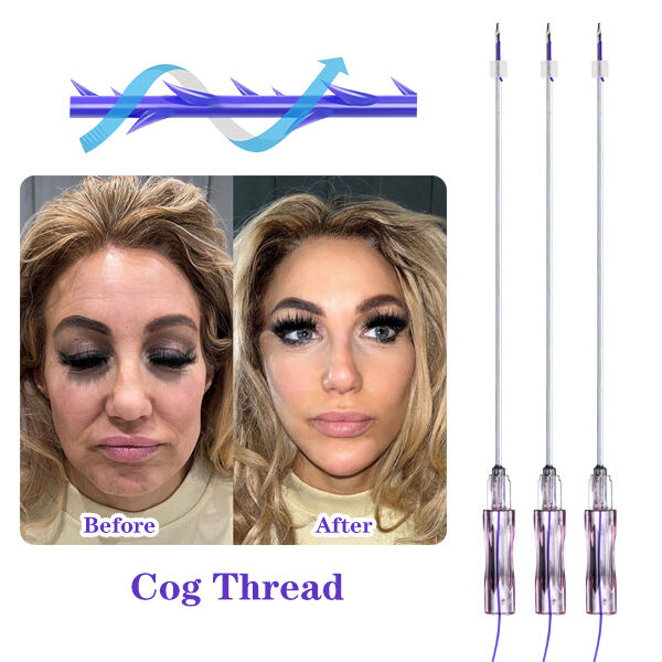 Kif Tista' Tistamma Pdo Cog Threads: Passi Sempji Għal Risultat Eċċelenti?