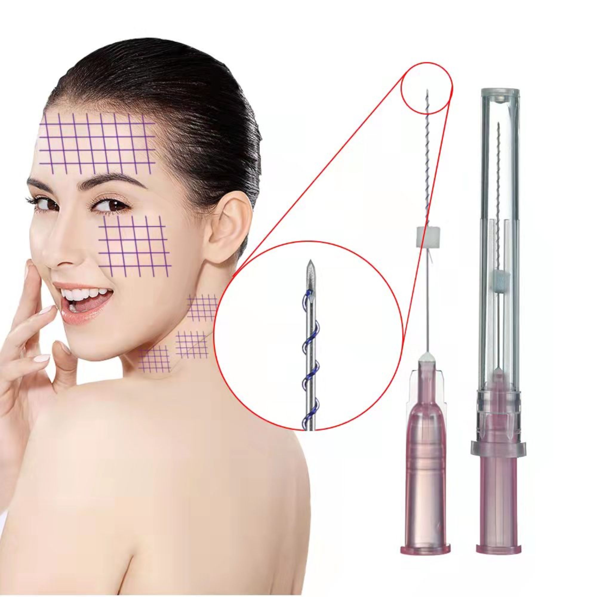 Medical Absorbable Face Lifting Hilos 29g 30g 25mm Pdo Screw Threads With Sharp Needle