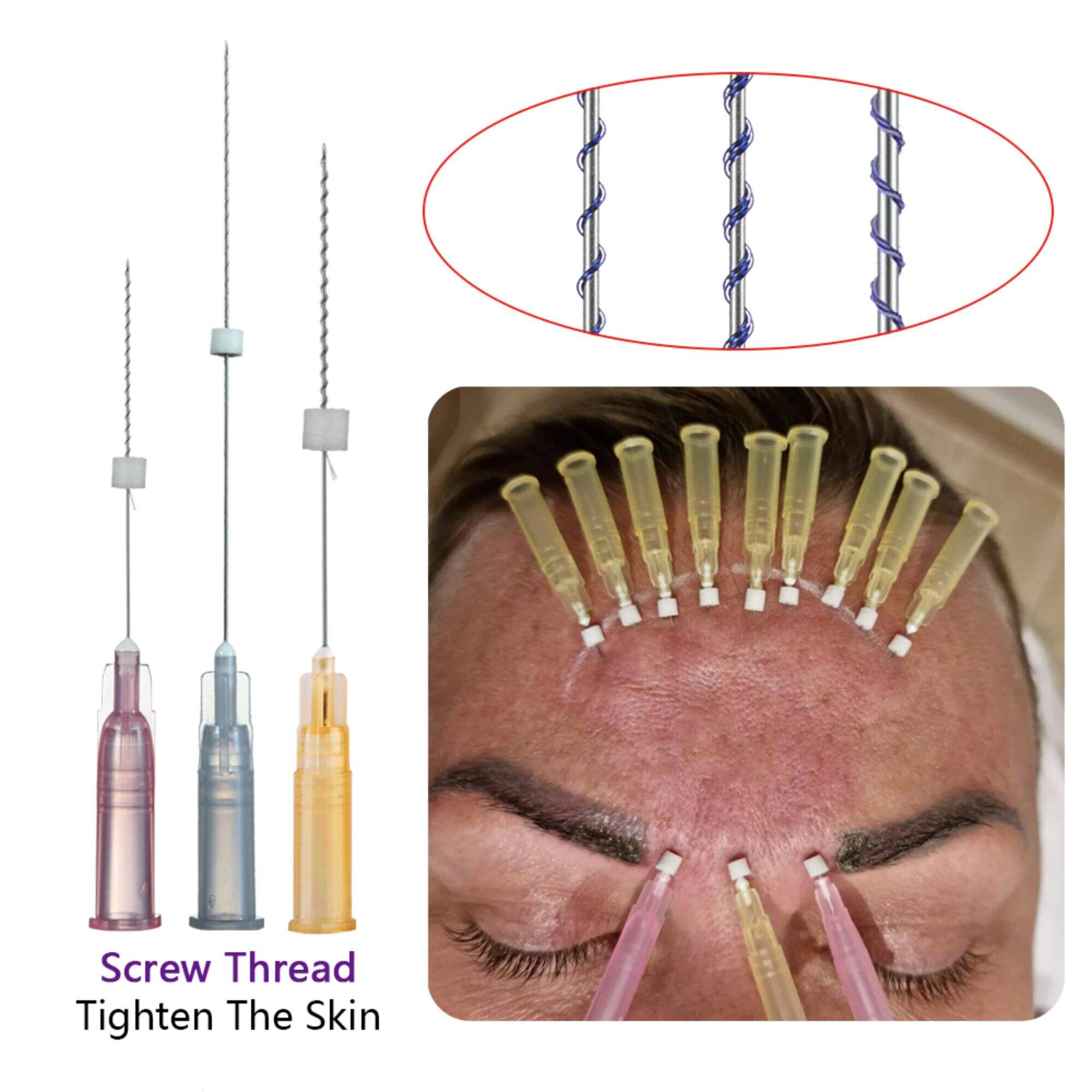 26g 27g 29g 30g Twist Hilos Tensores Sharp Needle Screw Thread Face Lift PLLA