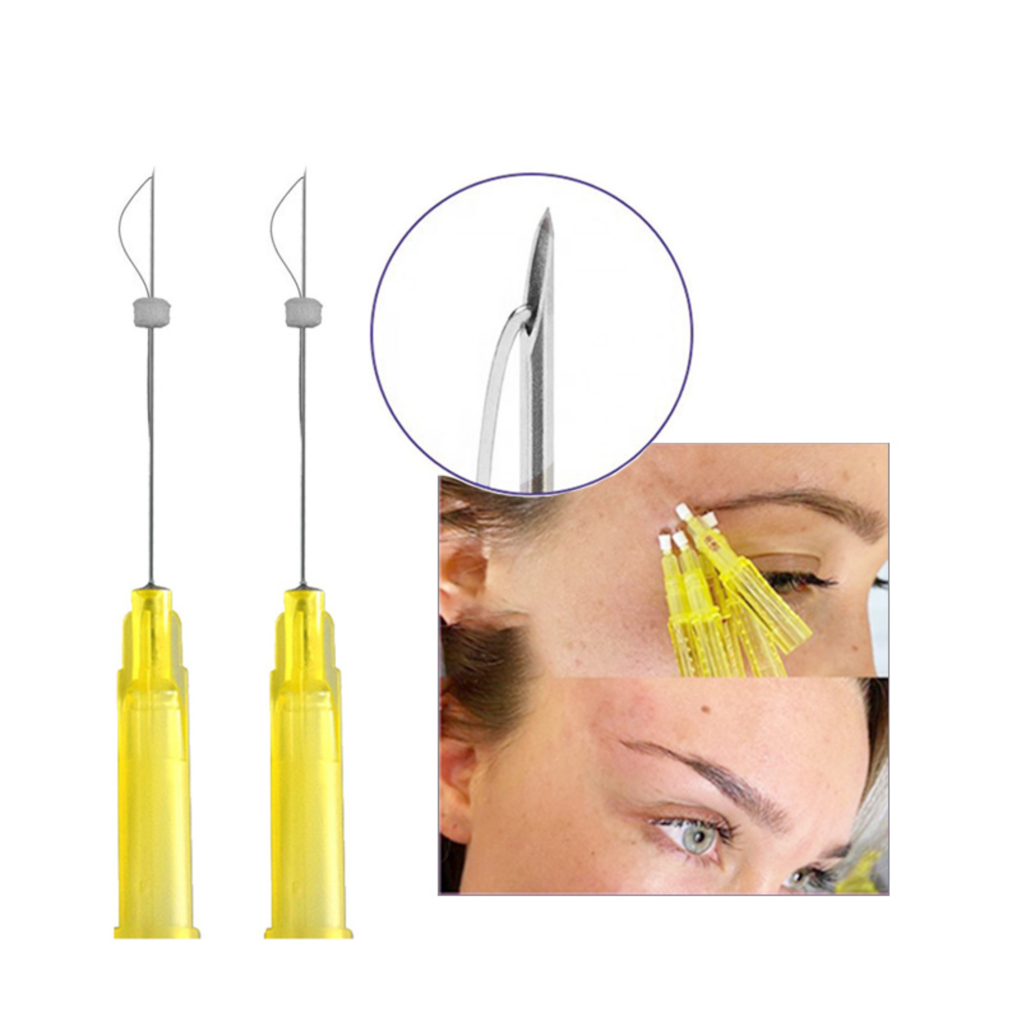 Beauty Clinic Removal Wrinkles 26g 27g 29g 30g Hilos Tensores Smooth Mono Fios De Pcl Lift Thread